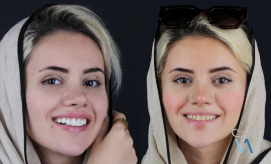 دندانپزشکی زیبایی